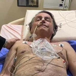 Bolsonaro está sem dor e pode não precisar de cirurgia, diz fonte do governo