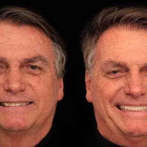 Bolsonaro faz harmonização facial e coloca lentes nos dentes