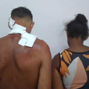 Casal acusado de espancar criança de 2 anos é transferido para o Conjunto Penal de Teixeira de Freitas; criança recupera-se das agressões